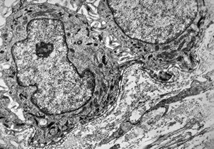 F,23y. | normal oral mucosal epithelium